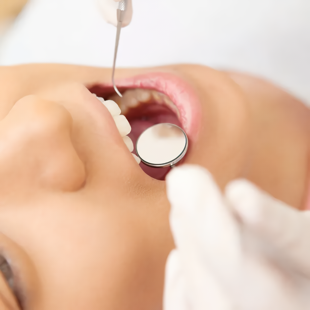 高精度診断で虫歯の早期発見・早期対応