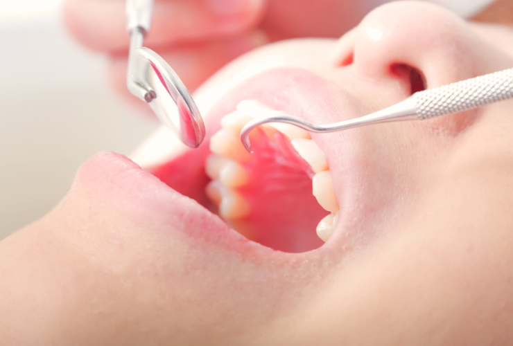 天然歯は一度削ってしまうと元に戻らないため、削る量は最小限にしております