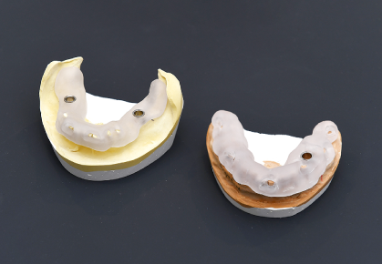 シミュレーションに基づいた「サージカルガイド」を作製・使用しています。