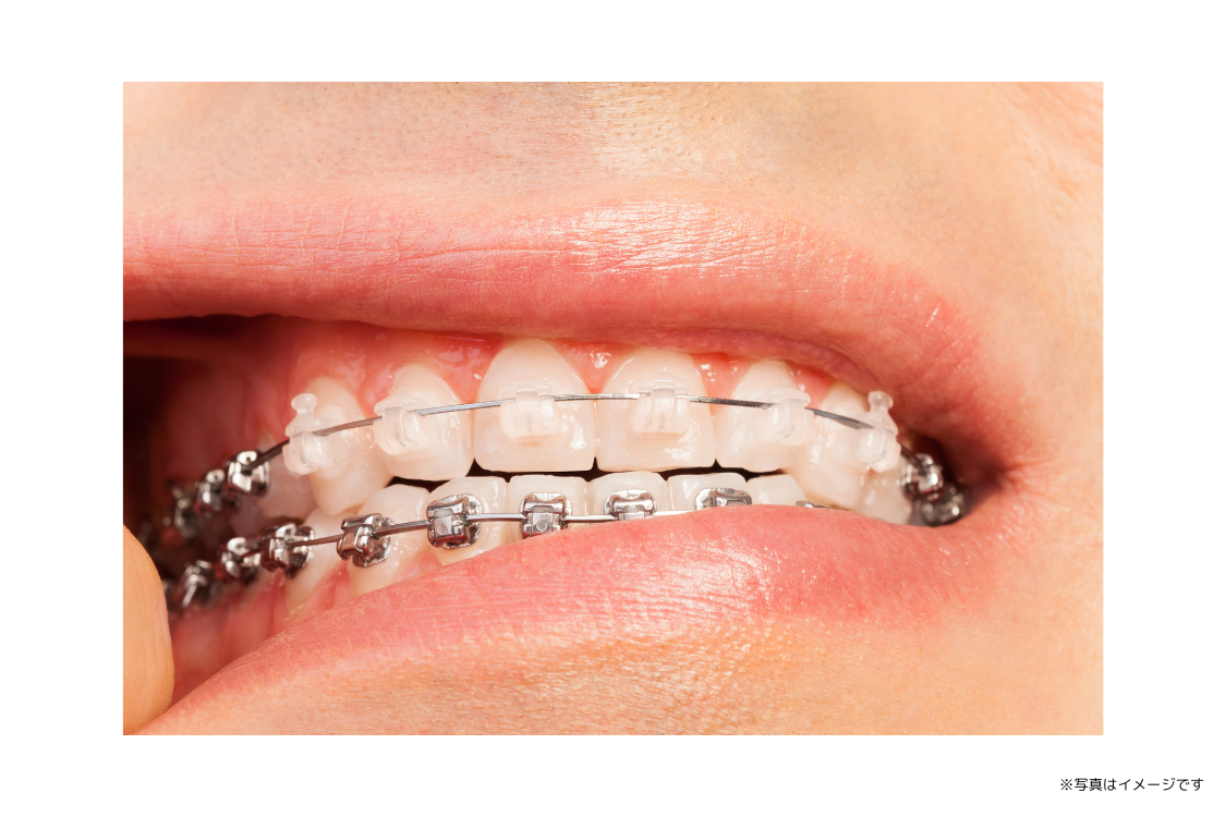 ※イメージ画像