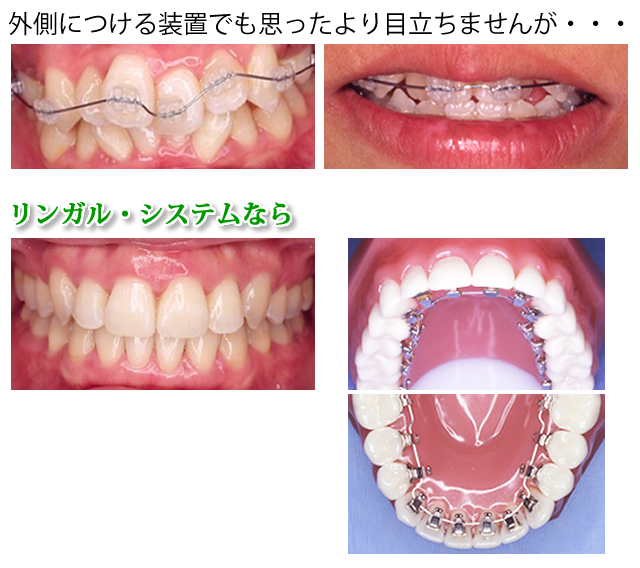 患者様一人ひとりに最適な矯正治療を提供します