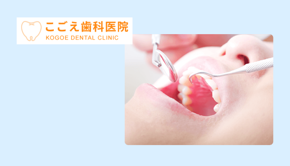 【予防歯科|健康な歯を守るために】