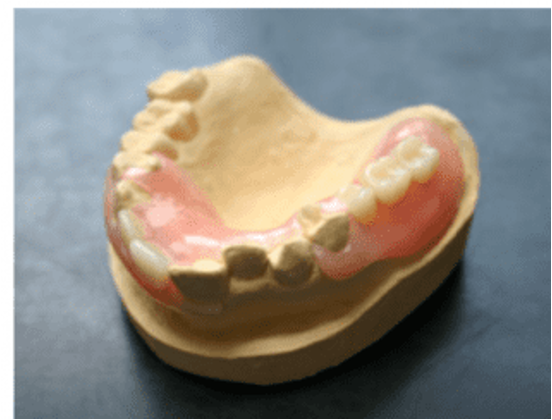 最適な入れ歯をご提案いたします