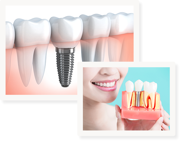 不快感や緊張を軽減しやすい手術方法を採用しています