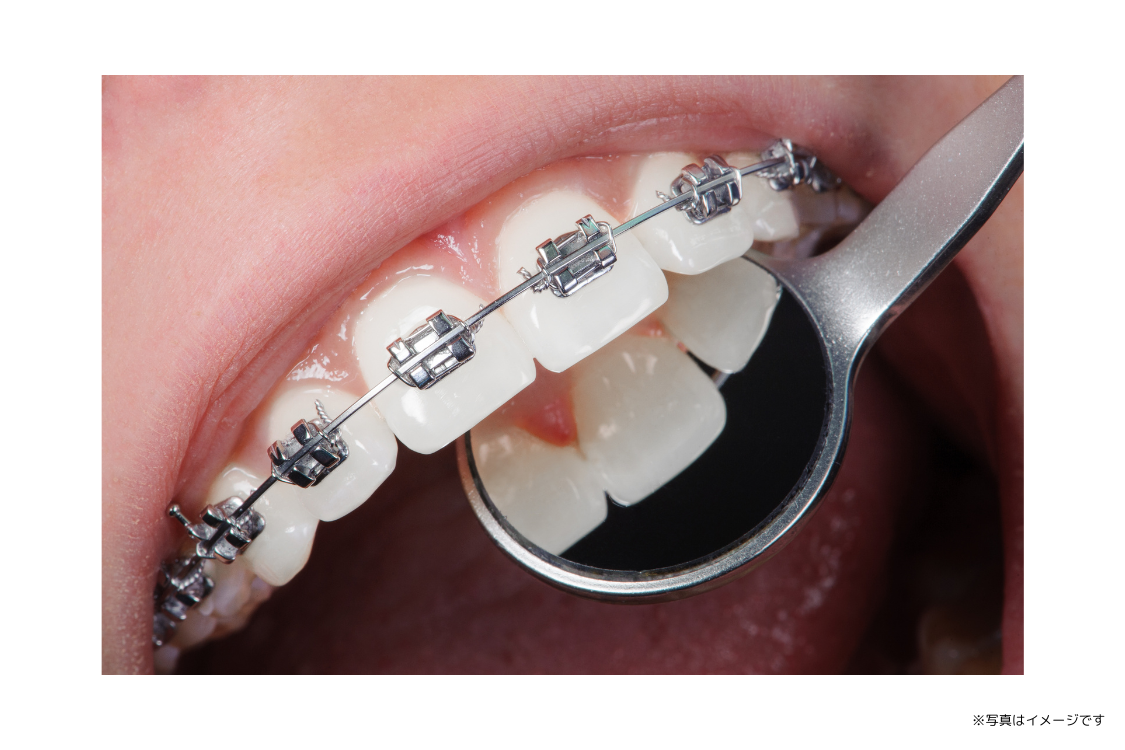 ①スタッフ一同 ②③イメージ写真