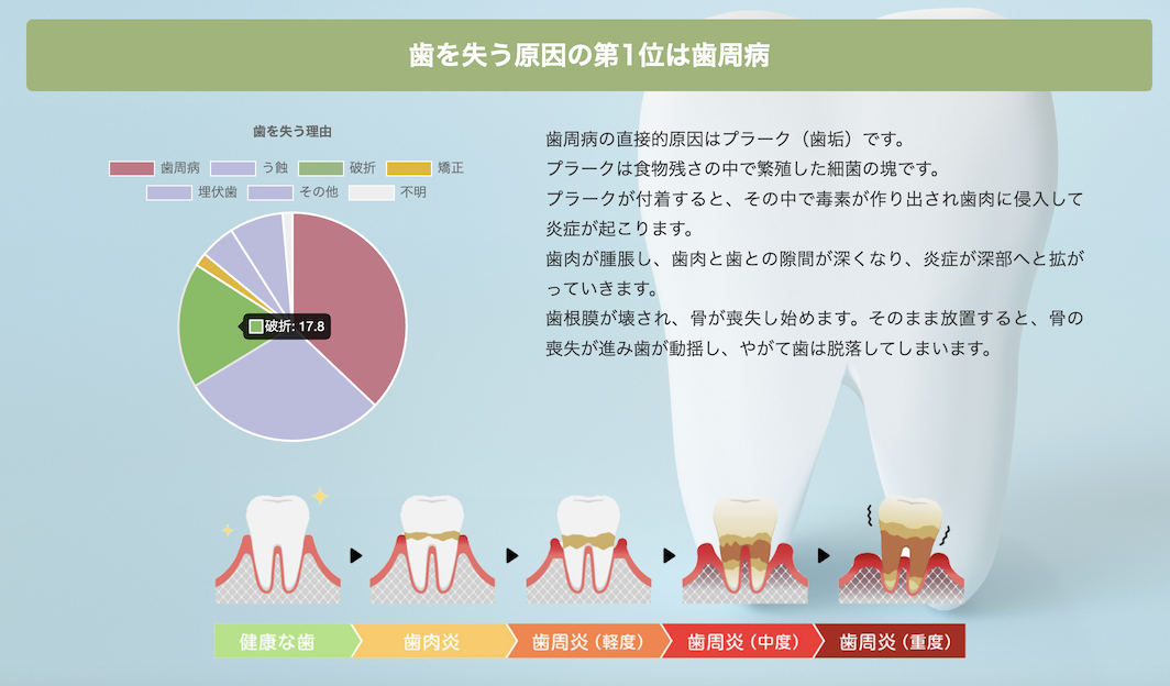 日本の歯科医院のわずか3%しか導入していない顕微鏡を用いた精密な歯周病治療を実施しています