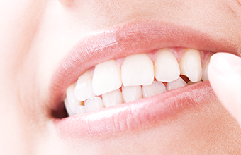 患者様のQuality of Life向上を目指す歯科医療