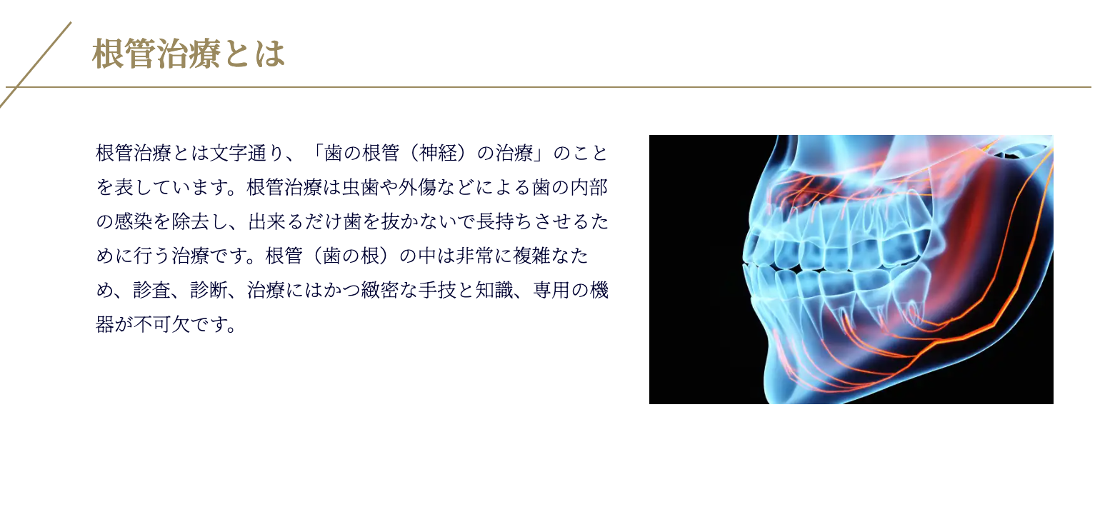 マイクロスコープや歯科用CTを活用し、目視では確認が難しい細部までしっかりと診断します