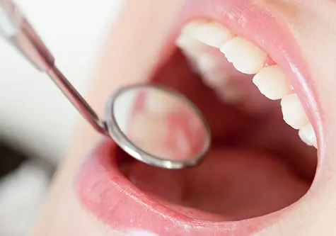 一人ひとりに合わせた予防プログラムで健康な歯を維持します