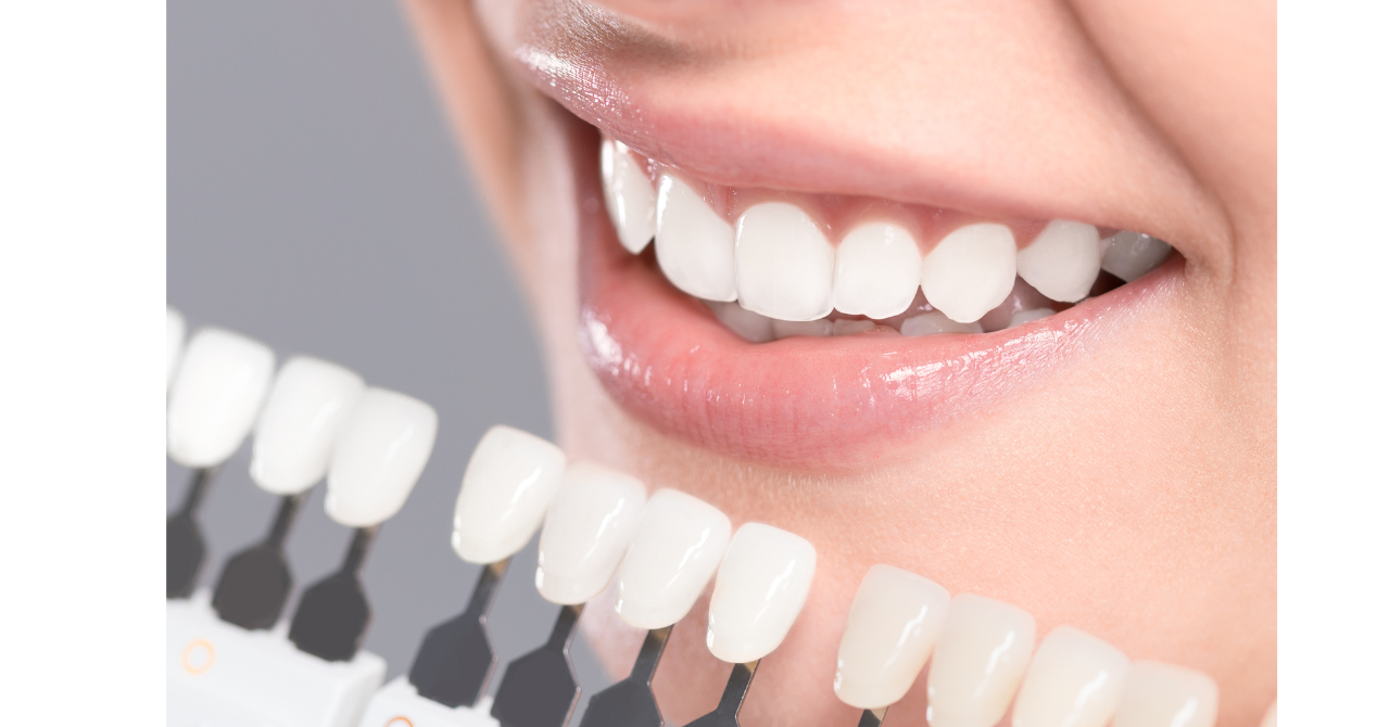 金属不使用で安全・審美的な口元を叶える最新素材の活用