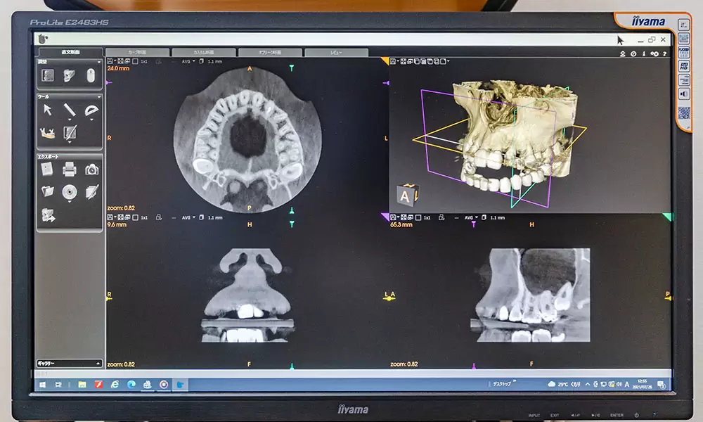 見た目の改善だけでなく、不正咬合や発音障害の改善、むし歯・歯周病の予防にもつながる治療