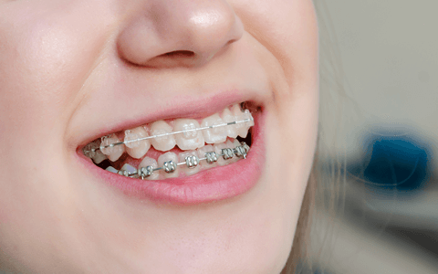 お子様の成長を利用した矯正を行っています。※画像はイメージです。