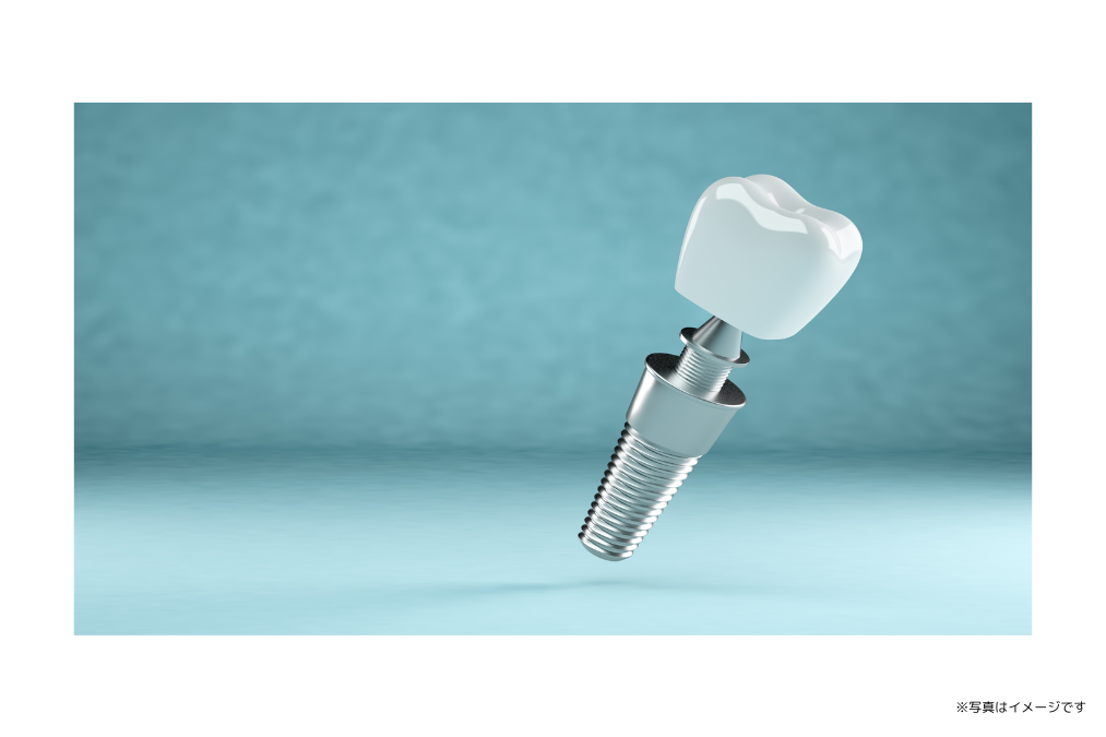 患者様の状態に合わせた治療計画の立案と丁寧なカウンセリングを通じて、不安を取り除く工夫を行っています