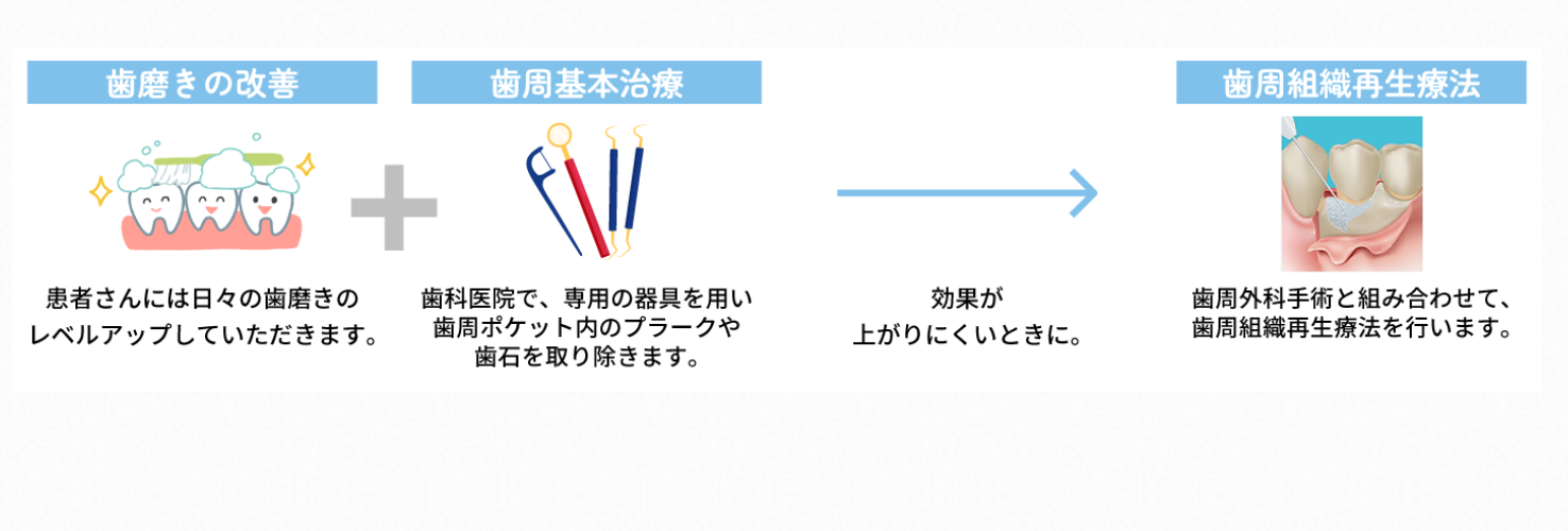 歯周病の早期発見・早期治療に力を入れています