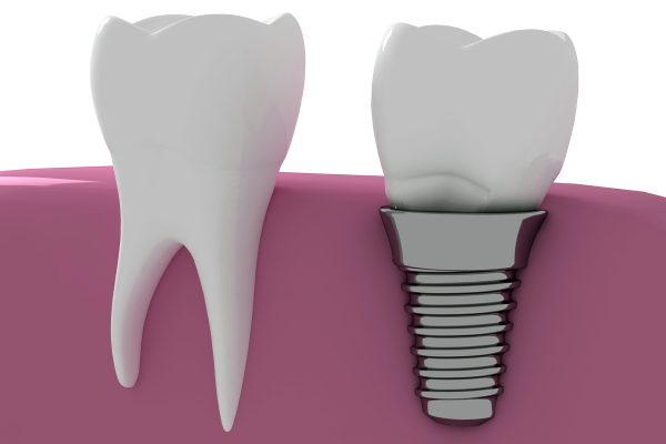 ※画像はイメージです