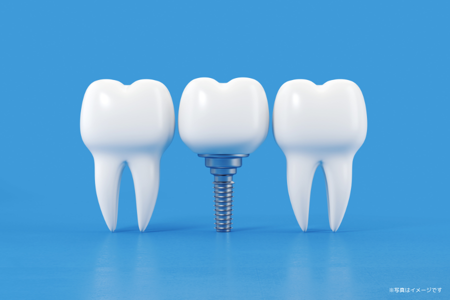 歯を失った方に向けて、機能性と審美性の両面に配慮したインプラント治療が提供されています