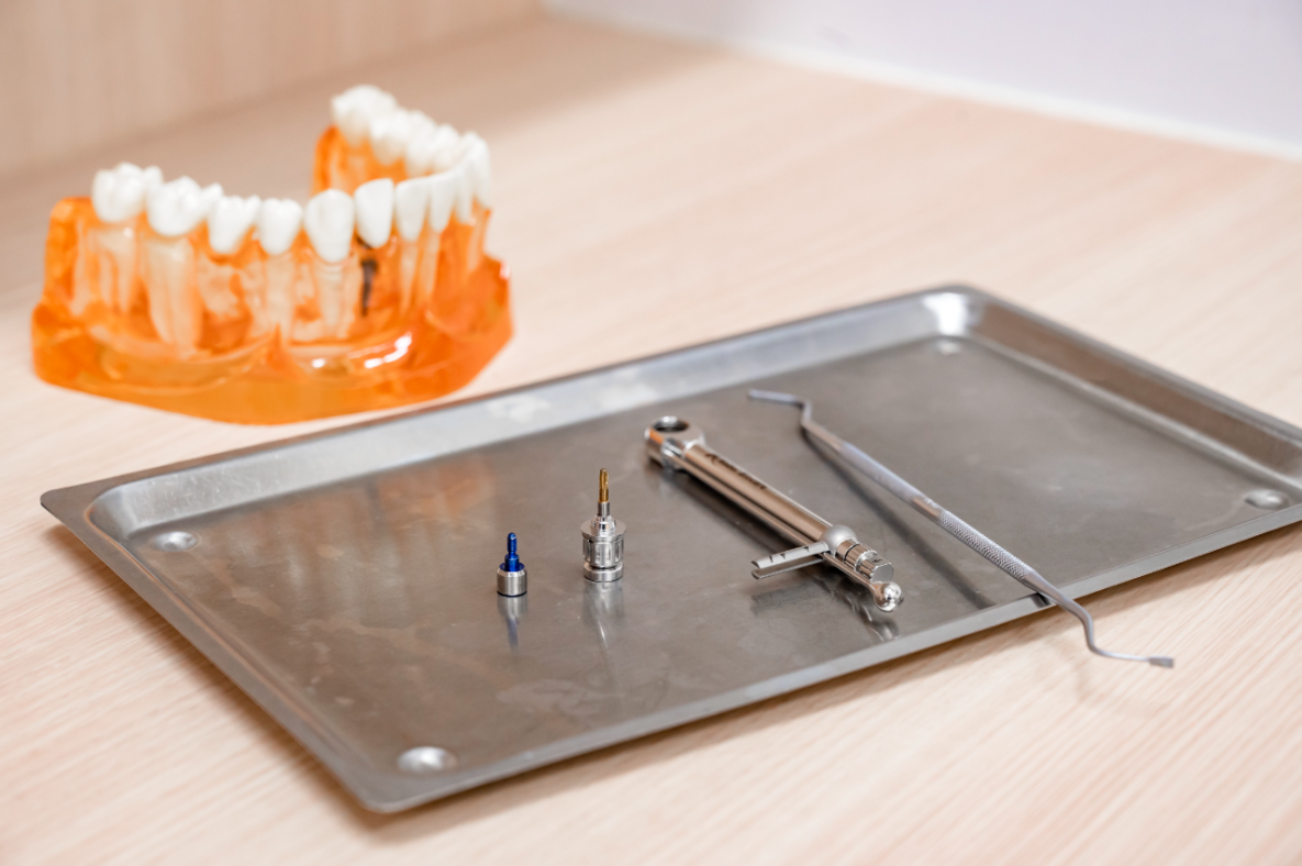 定期的な診査を通じて、インプラントの寿命を延ばすサポートを行います