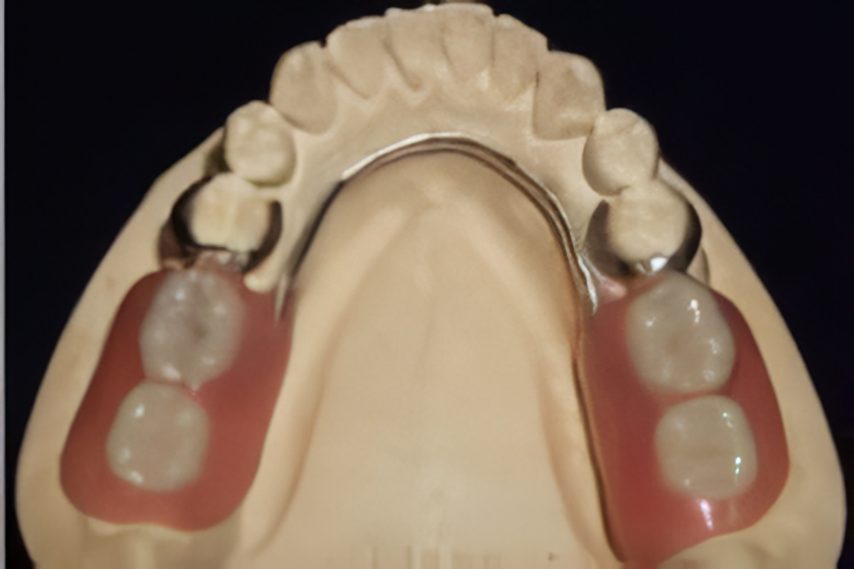 入れ歯のイメージ