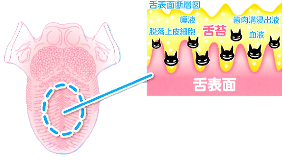 むし歯や歯周病の予防だけでなく、口臭対策にも配慮した総合的なケアを行っています