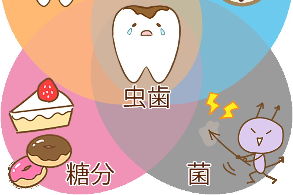 糖分や虫歯菌によって虫歯になります