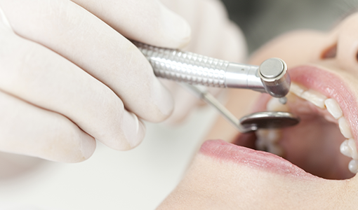 日本歯周病学会が認定する歯周病専門医が中心となり、歯周病治療を幅広く実施しています