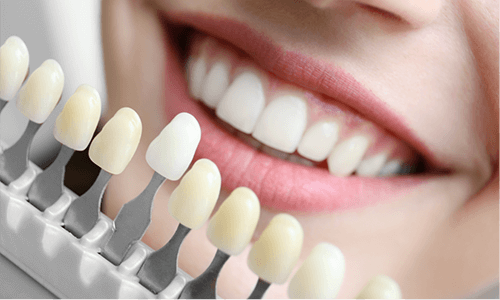 歯の黄ばみや着色を効果的に取り除き、自然で美しい白さを追求するホワイトニング治療を提供しています