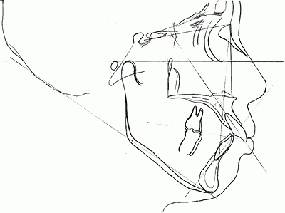 かみ合わせと口元の調和を大切にしています