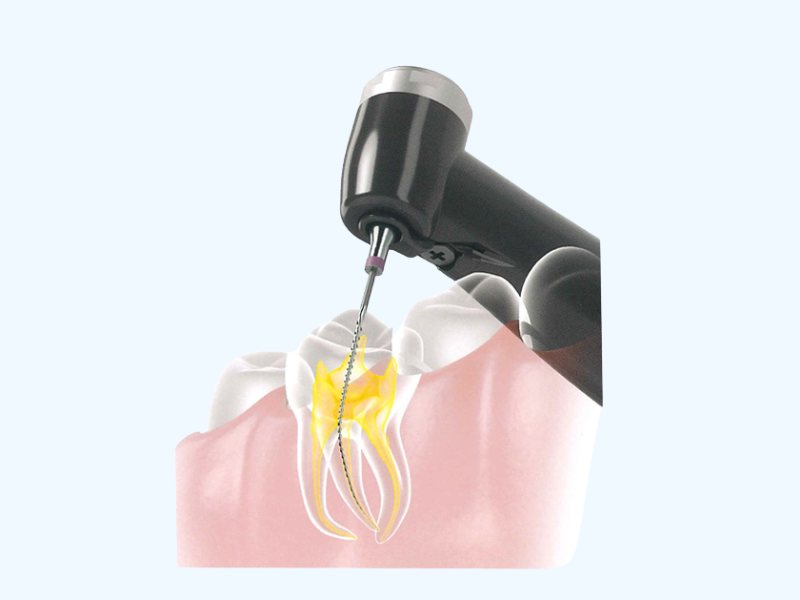 トライオートによる治療を導入しています