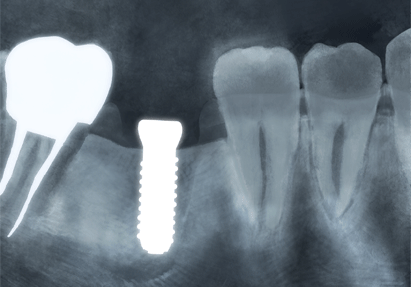 写真はイメージです