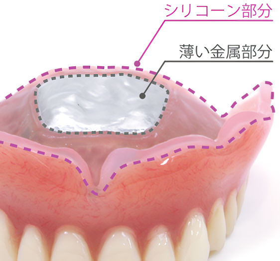 入れ歯の痛みでお悩みなら是非ご相談を