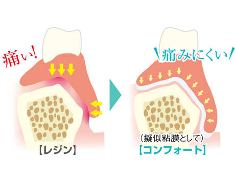 有床義歯-痛くない、外れにくい!シリコン入れ歯で食生活が変わる