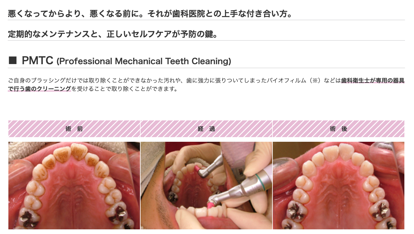 「悪くなってからの治療」ではなく、「悪くなる前の予防」を重視した予防歯科を提供しています
