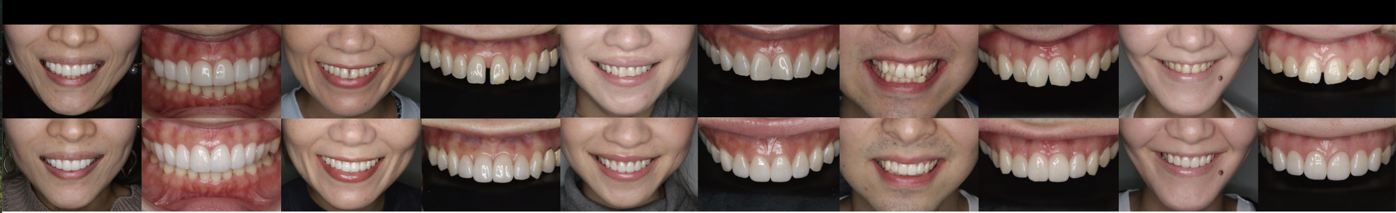 やり直しのない治療を目標に、天然歯と調和した健康的な仕上がりを追求しています