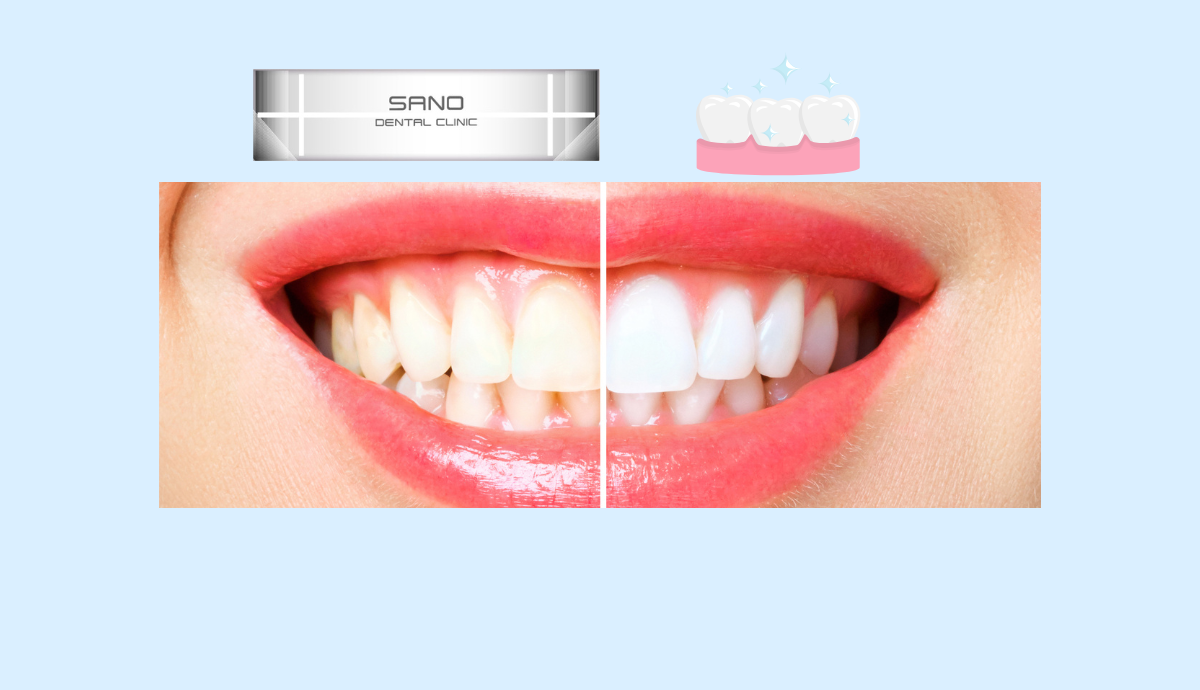 美しく、機能的な口元を目指す審美歯科