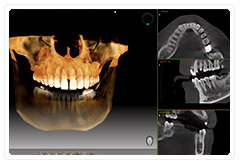 3次元的な立体画像