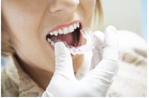 ホームホワイトニングではマウスピースを使用します