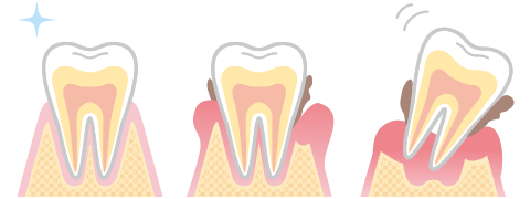 歯周病の進行を防ぐための専門的な診療を重視しています