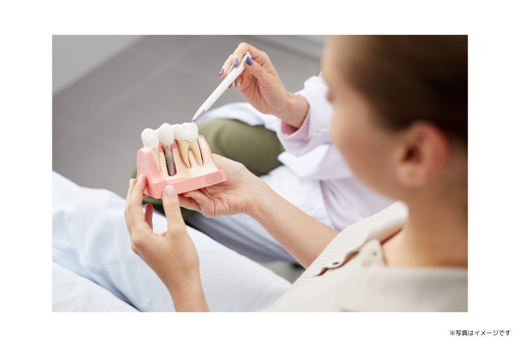部分入れ歯や総入れ歯が合わずにお悩みの方に対し、人工歯根を用いた治療を提案しています