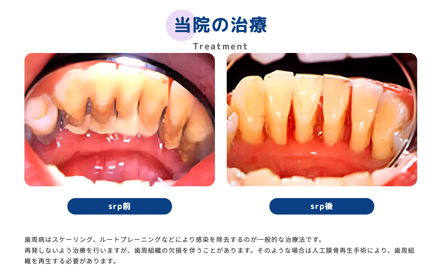 患者様のお口の状態を丁寧に診断し、一人ひとりに合った治療法をご提案しています