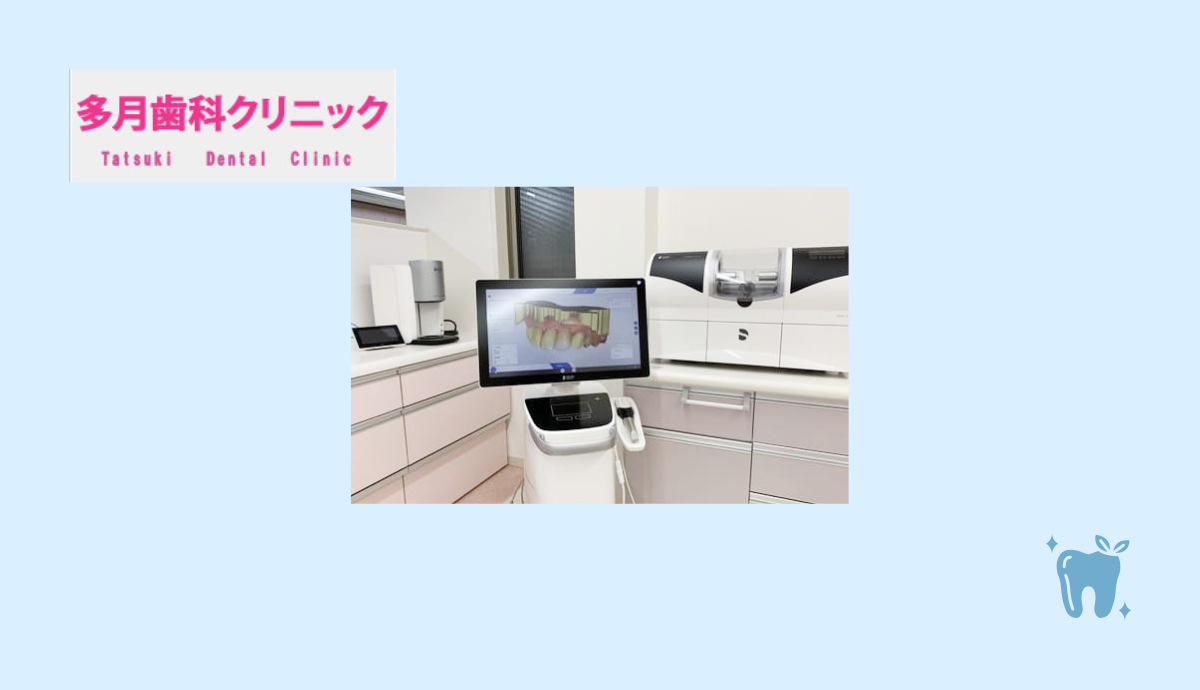 セレックシステム