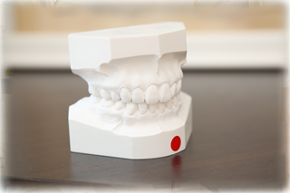 装置が目立ちにくいため、矯正中も自然な笑顔で過ごせます