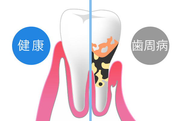 早期に治療を行いましょう