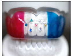 スポーツによるケガを防ぎましょう