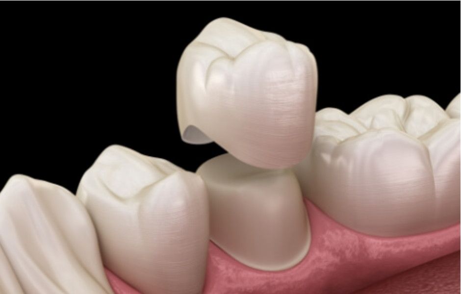 ジルコニアを精密に加工する機器を完備