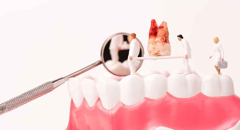 大切な歯を守りましょう