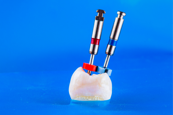 ※画像はイメージです