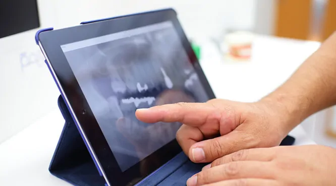 咬み合わせのズレや顎の不調に関する症状にも対応しております