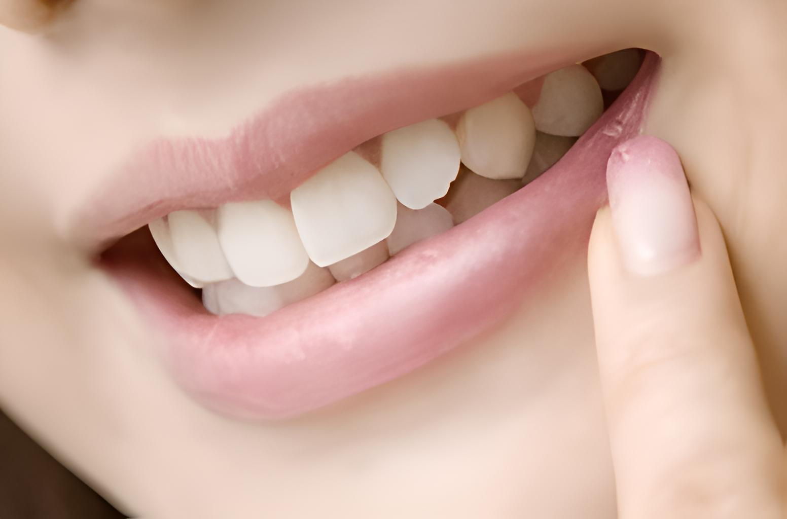 安全性の高いホワイトニング剤と継続的なケアで白く美しい歯を維持