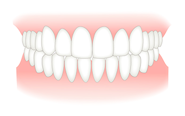 自信の持てる口元を目指しましょう
