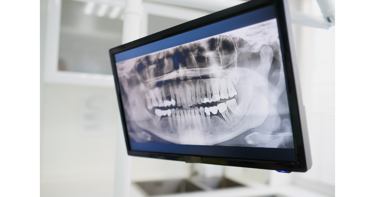 ※画像はイメージです